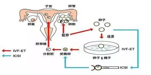 南昌婴儿试管